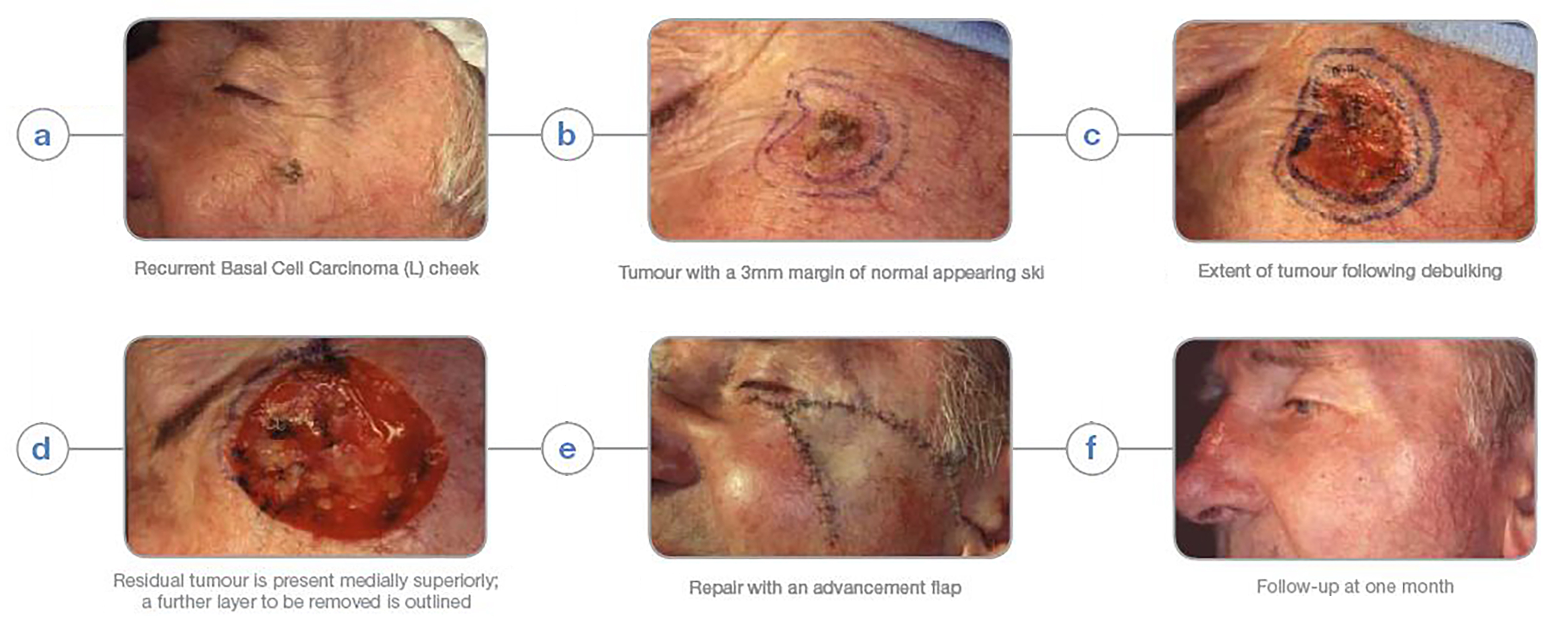 Dermatology Dermatology Consultants