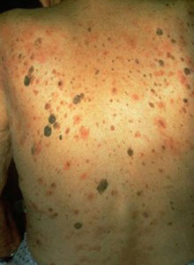 Common Conditions - Dermatology Consultants